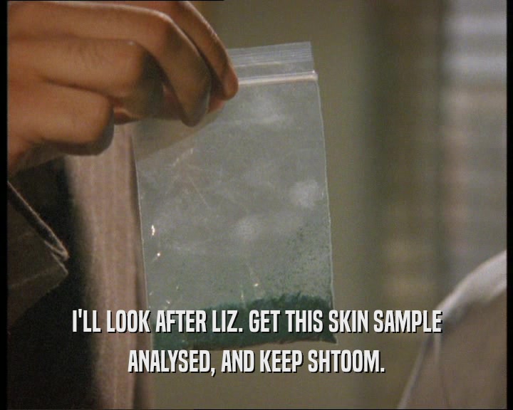 I'LL LOOK AFTER LIZ. GET THIS SKIN SAMPLE ANALYSED, AND KEEP SHTOOM. 
