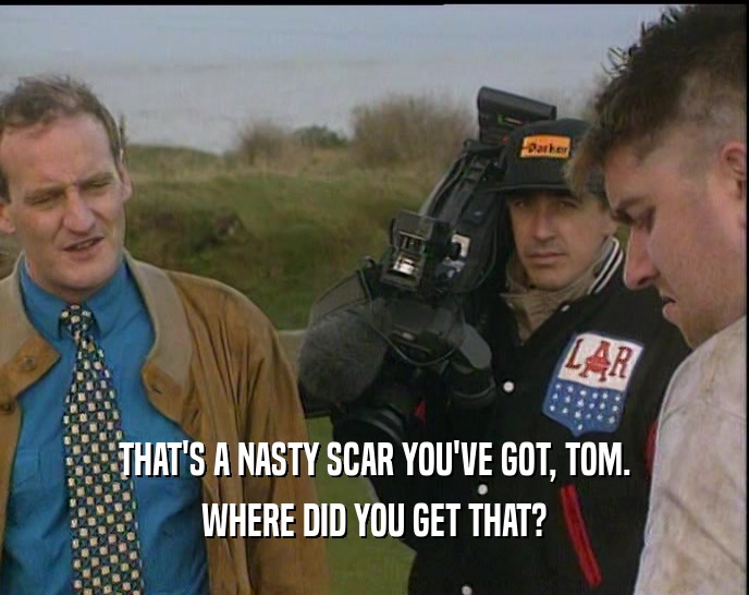 THAT'S A NASTY SCAR YOU'VE GOT, TOM.
 WHERE DID YOU GET THAT?
 