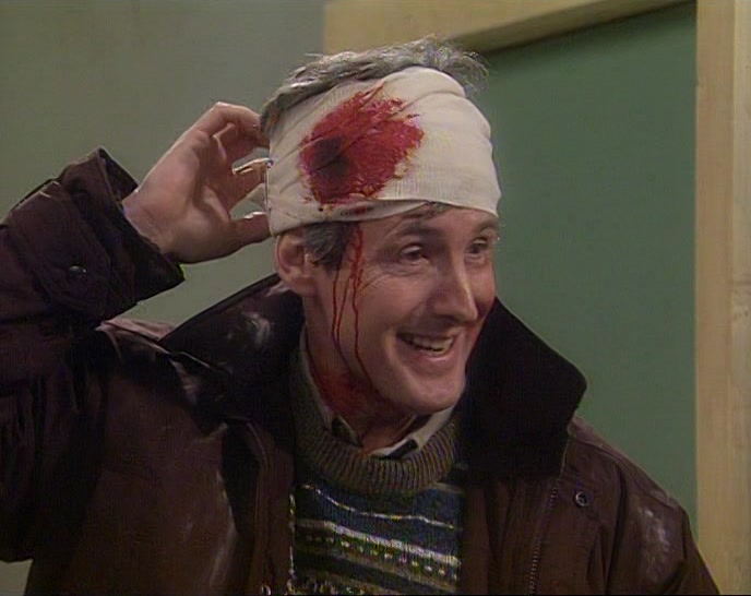 I JUST GOT A SLIGHT NICK WITH A KNIFE WHEN MARY WAS PUTTING THE BANDAGE ON. 