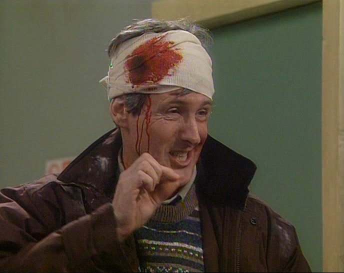 I JUST GOT A SLIGHT NICK WITH A KNIFE WHEN MARY WAS PUTTING THE BANDAGE ON. 