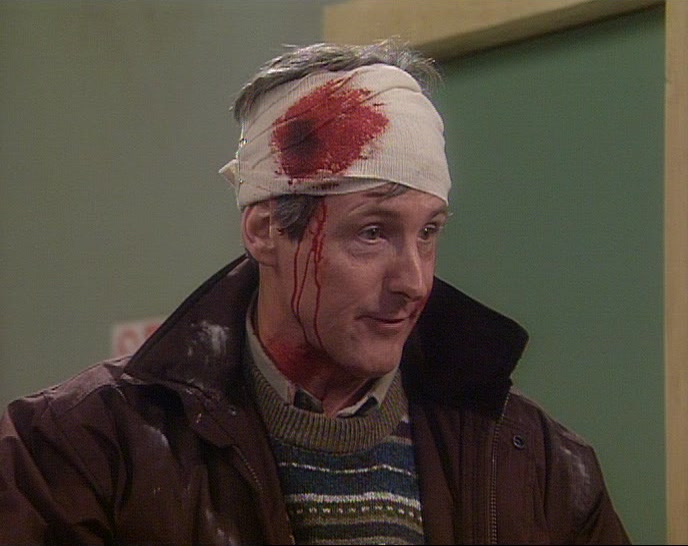 I JUST GOT A SLIGHT NICK WITH A KNIFE WHEN MARY WAS PUTTING THE BANDAGE ON. 