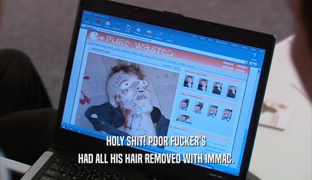 HOLY SHIT! POOR FUCKER'S HAD ALL HIS HAIR REMOVED WITH IMMAC. 
