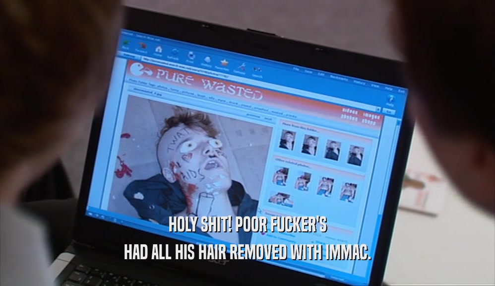 HOLY SHIT! POOR FUCKER'S HAD ALL HIS HAIR REMOVED WITH IMMAC. 