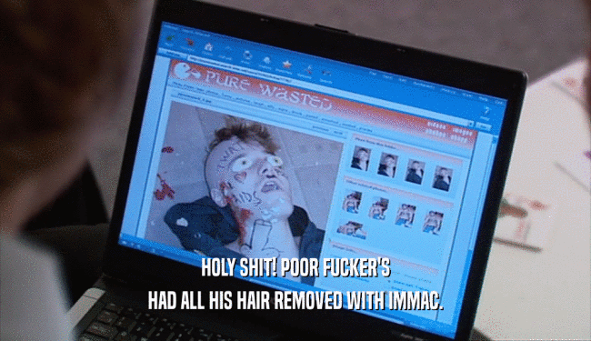 HOLY SHIT! POOR FUCKER'S HAD ALL HIS HAIR REMOVED WITH IMMAC. 