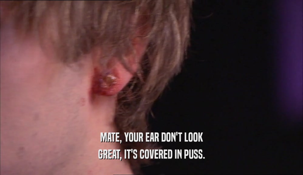 MATE, YOUR EAR DON'T LOOK GREAT, IT'S COVERED IN PUSS. 