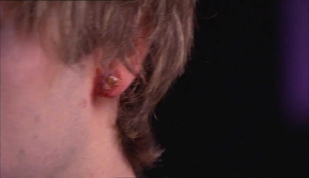 MATE, YOUR EAR DON'T LOOK GREAT, IT'S COVERED IN PUSS. 