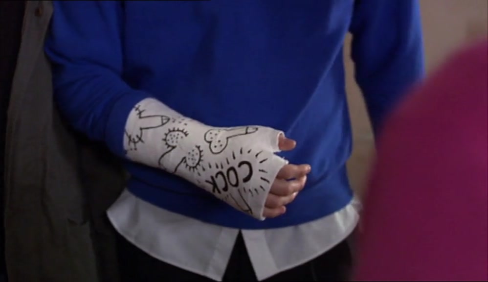NO, NOT THE CAST, WHAT'S ON IT. COVER IT UP. YOUR GRANNY'S GOING TO BE HERE IN A MINUTE. 