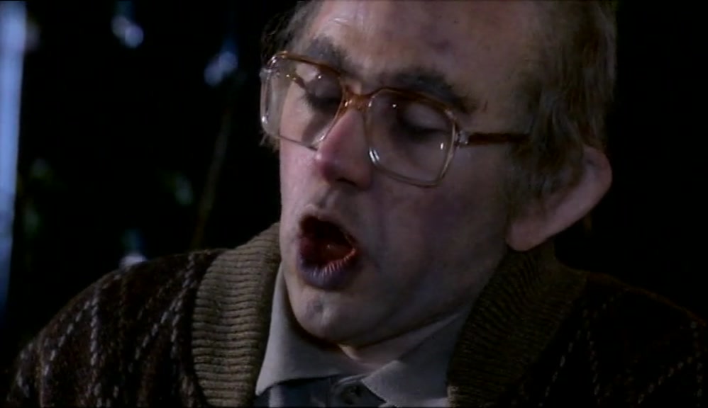 OH, WELL, I SUPPOSE, LIKE, HE NEEDS JUST A GOOD DENTIST! 