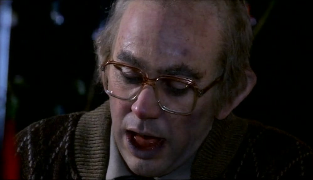 OH, WELL, I SUPPOSE, LIKE, HE NEEDS JUST A GOOD DENTIST! 