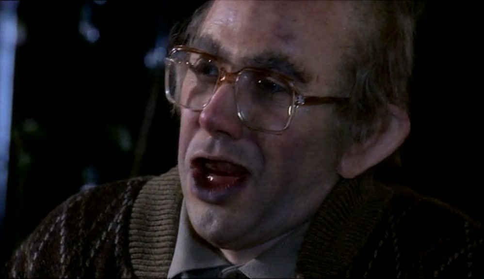 OH, WELL, I SUPPOSE, LIKE, HE NEEDS JUST A GOOD DENTIST! 