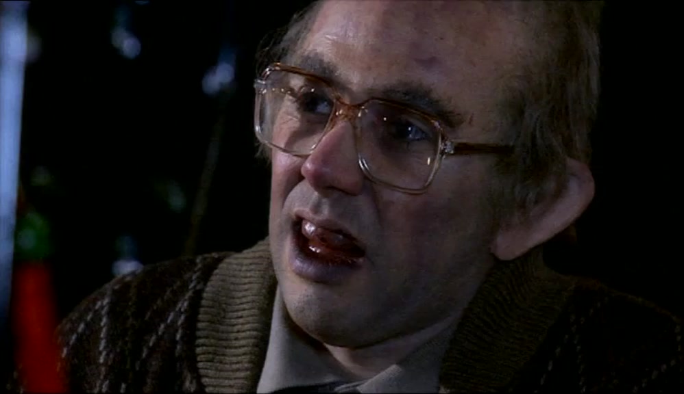 OH, WELL, I SUPPOSE, LIKE, HE NEEDS JUST A GOOD DENTIST! 