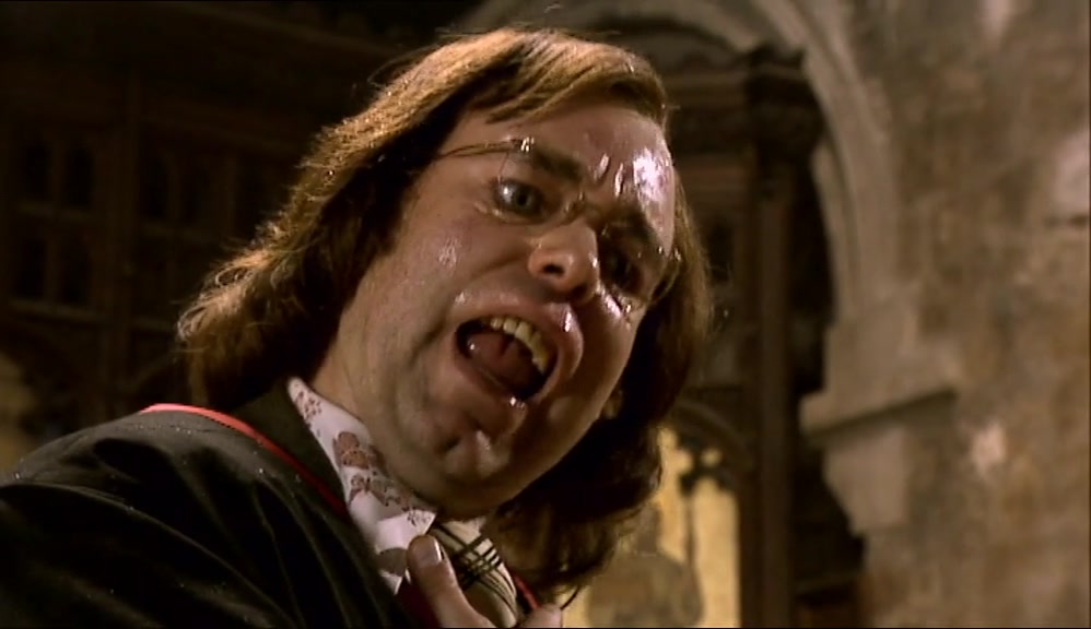 YOU'RE A VAMPIRE!  