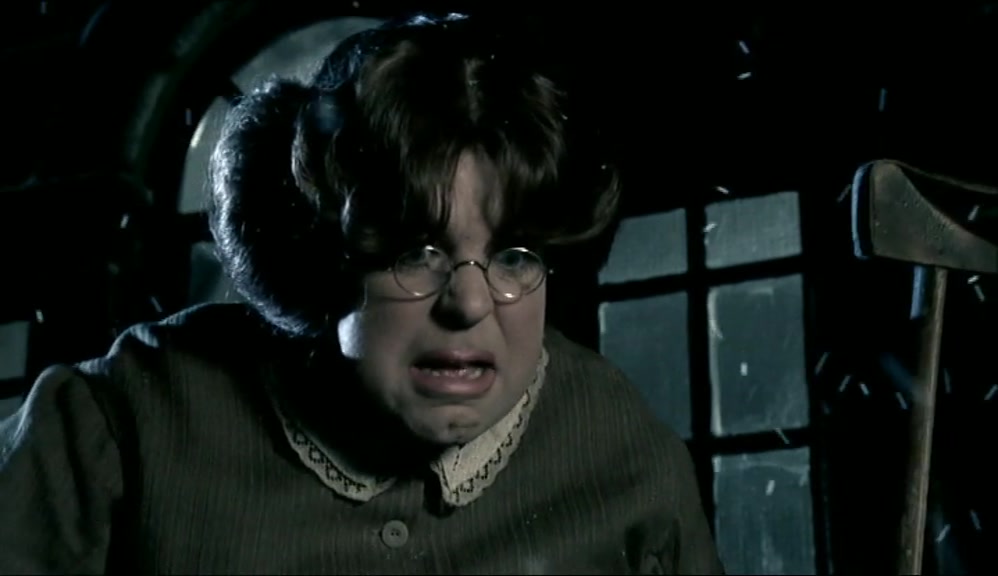 WHAT HAVE I TOLD YOU ABOUT CRUTCHES ON THAT TREADMILL? 