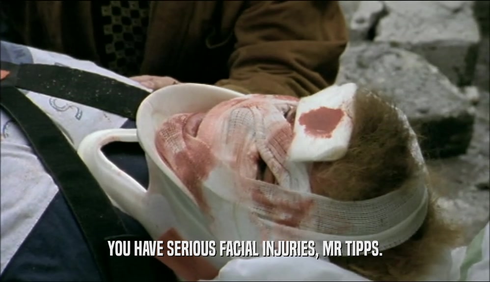 YOU HAVE SERIOUS FACIAL INJURIES, MR TIPPS.
  