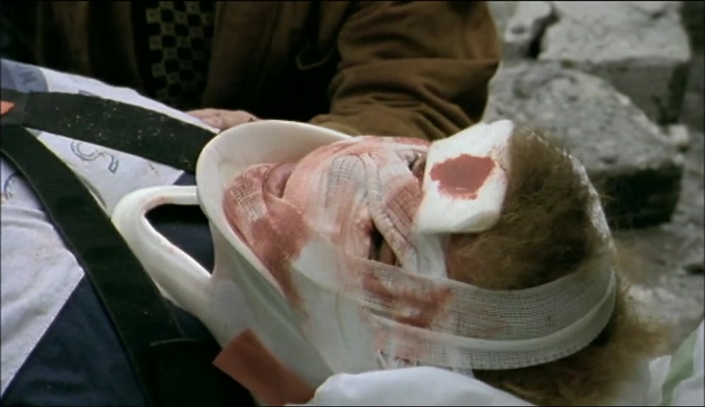 YOU HAVE SERIOUS FACIAL INJURIES, MR TIPPS.  