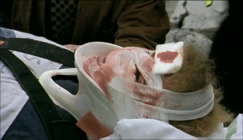 YOU HAVE SERIOUS FACIAL INJURIES, MR TIPPS.  