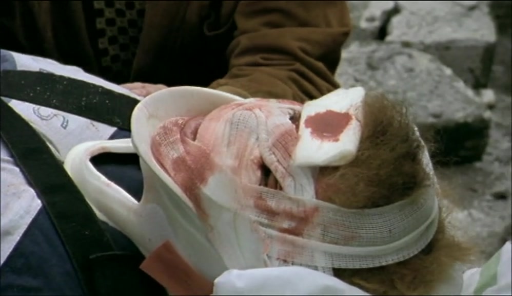- WE'LL HAVE TO OPERATE. - BUT HE'S AN ACTOR! 