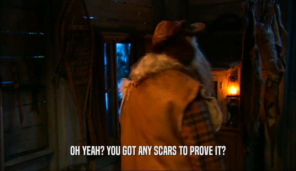 OH YEAH? YOU GOT ANY SCARS TO PROVE IT?  