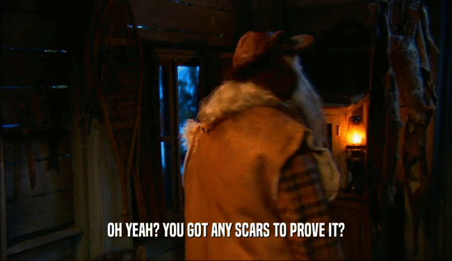 OH YEAH? YOU GOT ANY SCARS TO PROVE IT?  