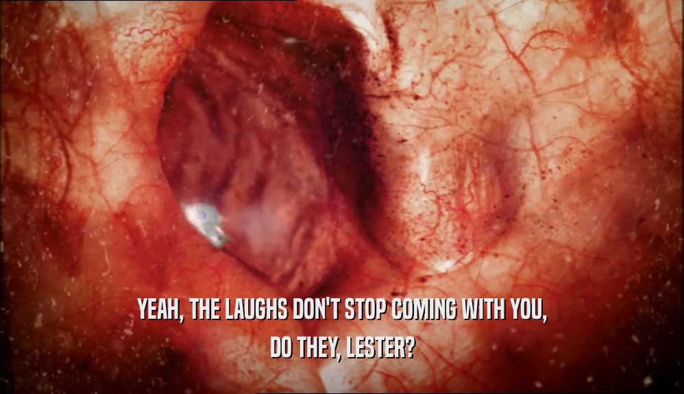 YEAH, THE LAUGHS DON'T STOP COMING WITH YOU, DO THEY, LESTER? 
