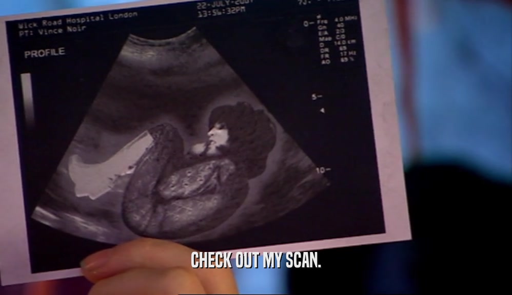 CHECK OUT MY SCAN.
  