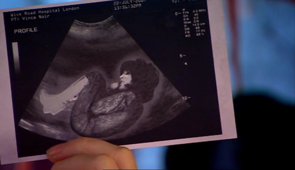 CHECK OUT MY SCAN.  