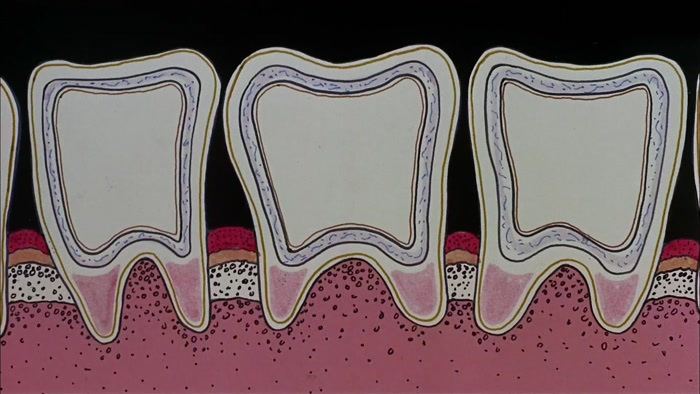 USING THIS DIAGRAM OF A TOOTH TO REPRESENT ANY SMALL COUNTRY... 
