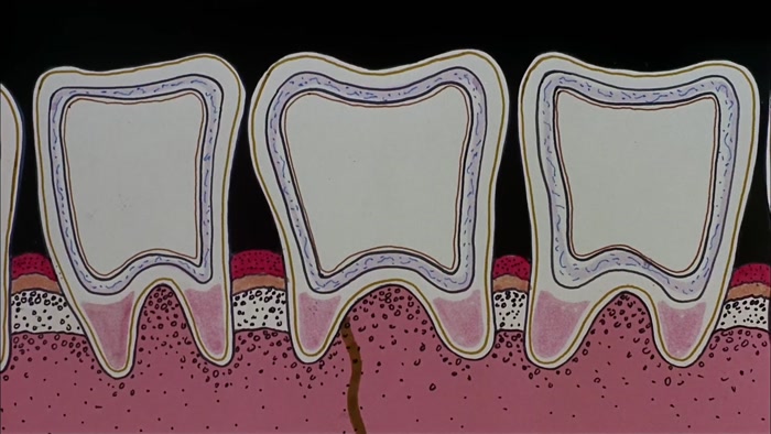 USING THIS DIAGRAM OF A TOOTH TO REPRESENT ANY SMALL COUNTRY... 