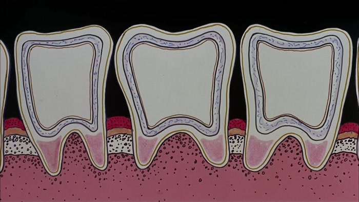 USING THIS DIAGRAM OF A TOOTH TO REPRESENT ANY SMALL COUNTRY... 