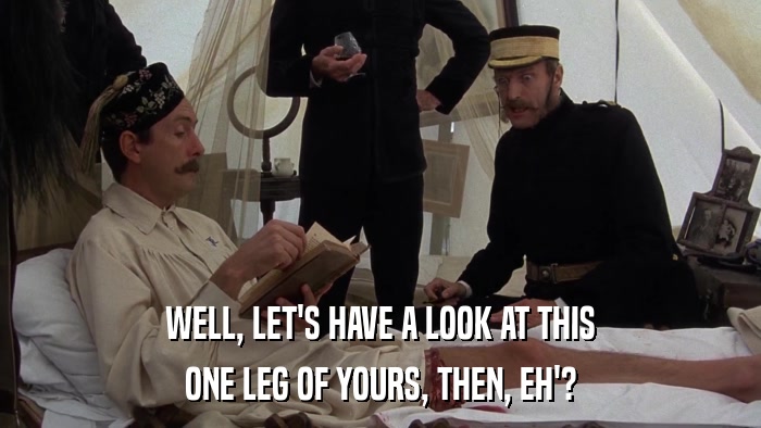 WELL, LET'S HAVE A LOOK AT THIS ONE LEG OF YOURS, THEN, EH'? 