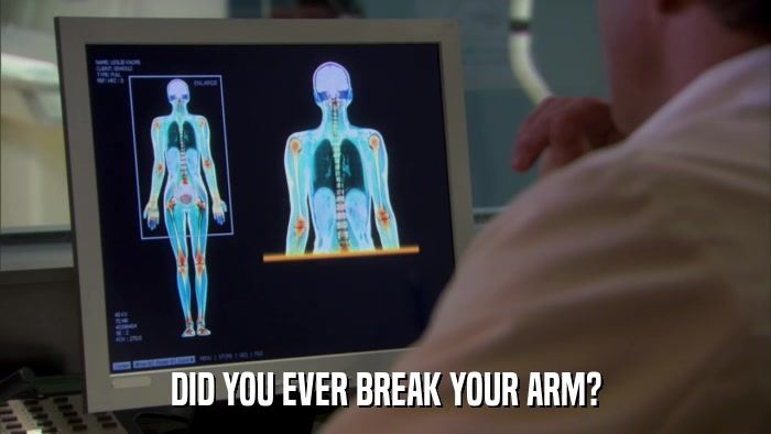 DID YOU EVER BREAK YOUR ARM?  
