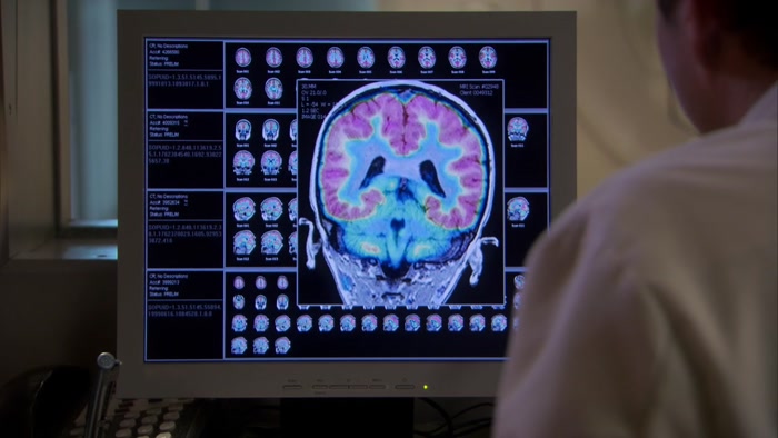 YOU'VE GOT A LARGE BRAIN.  
