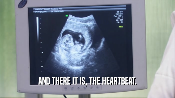 AND THERE IT IS, THE HEARTBEAT.  