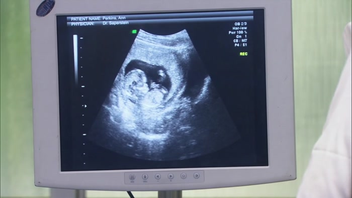 AND THERE IT IS, THE HEARTBEAT.  