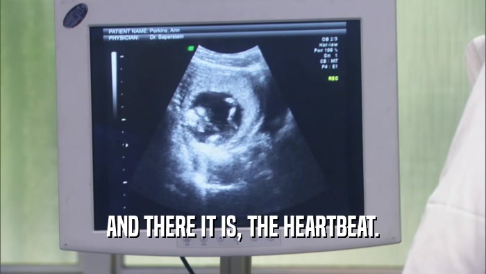 AND THERE IT IS, THE HEARTBEAT.  