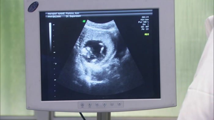 AND THERE IT IS, THE HEARTBEAT.  