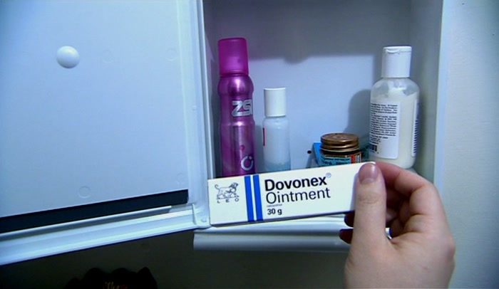 'ONE OF THE LESS COMMON SKIN AILMENTS. YEAST INFECTION. 