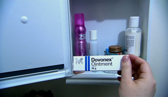 'ONE OF THE LESS COMMON SKIN AILMENTS. YEAST INFECTION. 