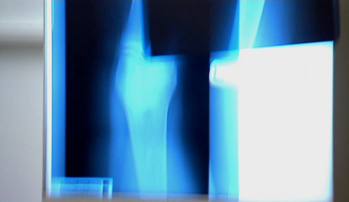 (MARK) 'DOCTOR RUNCIMAN HAS SEEN THIS A THOUSAND TIMES. 