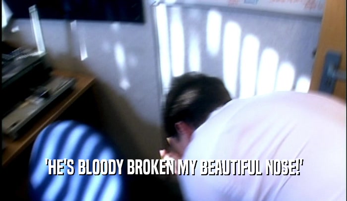 'HE'S BLOODY BROKEN MY BEAUTIFUL NOSE!'  