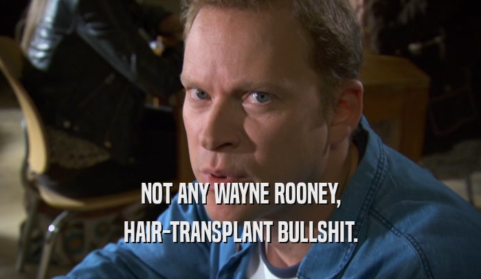NOT ANY WAYNE ROONEY, HAIR-TRANSPLANT BULLSHIT. 