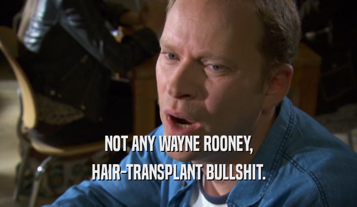 NOT ANY WAYNE ROONEY, HAIR-TRANSPLANT BULLSHIT. 