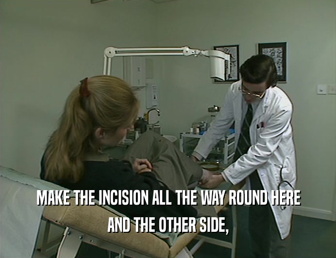 MAKE THE INCISION ALL THE WAY ROUND HERE AND THE OTHER SIDE, 