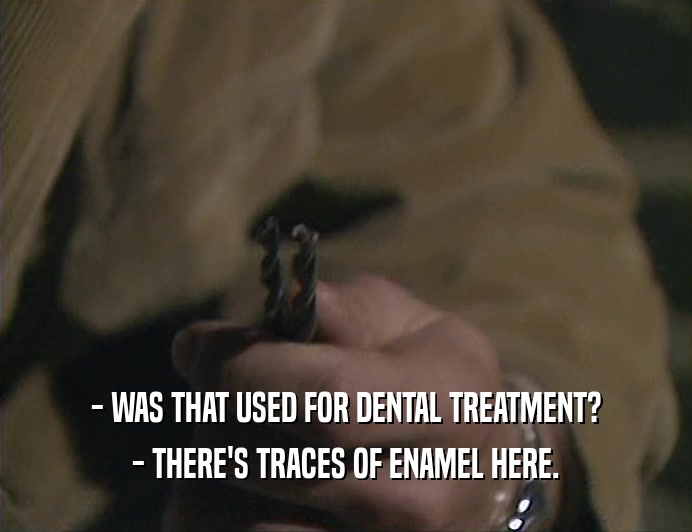 - WAS THAT USED FOR DENTAL TREATMENT? - THERE'S TRACES OF ENAMEL HERE. 