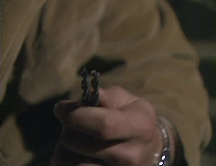 - WAS THAT USED FOR DENTAL TREATMENT? - THERE'S TRACES OF ENAMEL HERE. 
