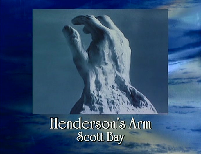 ALL FINGERS HAVE NOW FULLY EMERGED, ALONG WITH SECTIONS OF THE WRIST. 