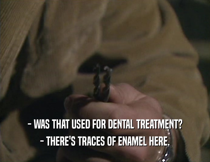 - WAS THAT USED FOR DENTAL TREATMENT? - THERE'S TRACES OF ENAMEL HERE. 