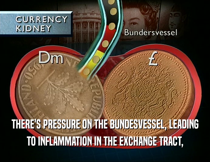 THERE'S PRESSURE ON THE BUNDESVESSEL, LEADING
 TO INFLAMMATION IN THE EXCHANGE TRACT,
 