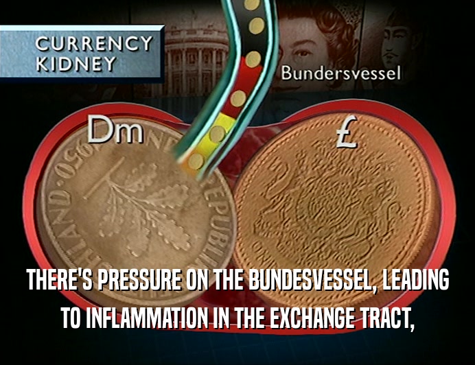 THERE'S PRESSURE ON THE BUNDESVESSEL, LEADING TO INFLAMMATION IN THE EXCHANGE TRACT, 