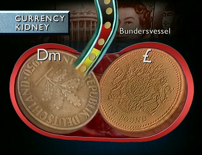 THERE'S PRESSURE ON THE BUNDESVESSEL, LEADING TO INFLAMMATION IN THE EXCHANGE TRACT, 